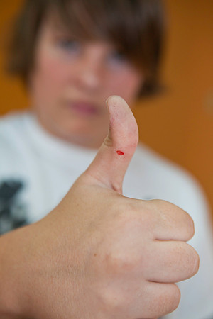 First Casualty